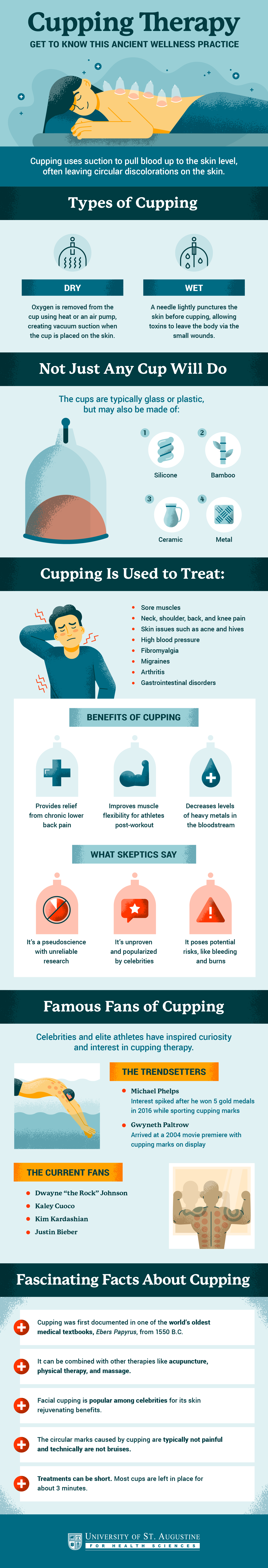 Infographic explaining cupping therapy